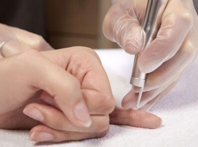 Provádění laserové terapie